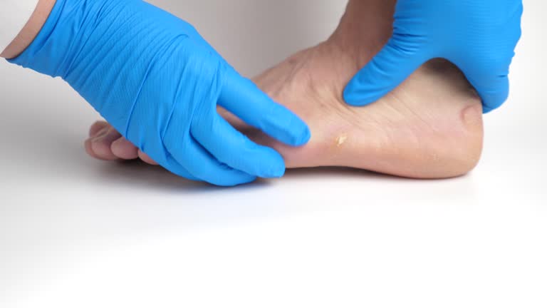 Foot Care Excellence at Ideal Feet Book Your Appointment Today